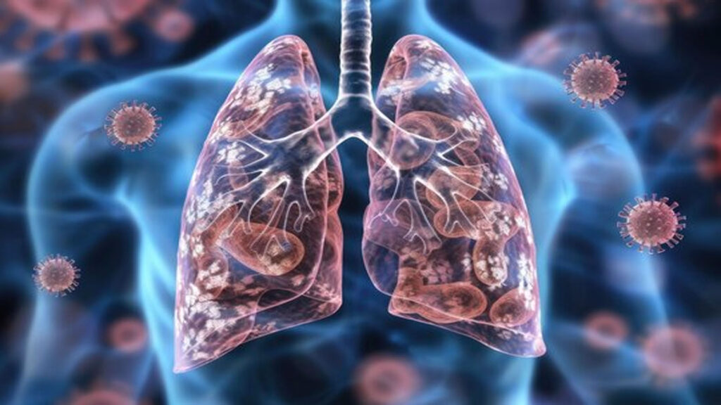 Respiratory Syncytial Virus